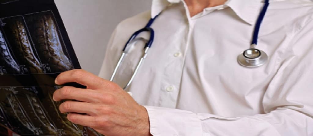x-ray photos on doctors hands
